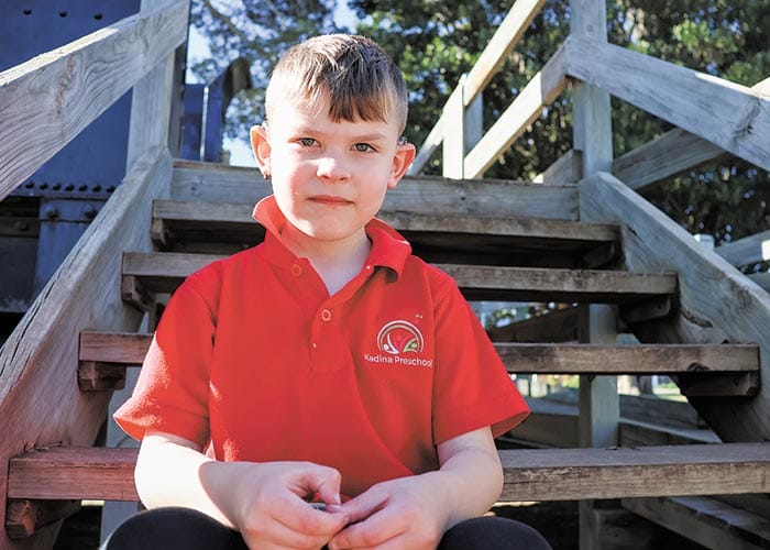 Compensation for cochlear failures post image